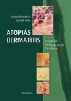 Dr. Schneider Imre - Atopis dermatitis