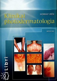 Dr. Horkay Ir�n - Klinikai photodermatologia