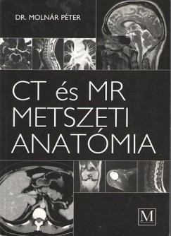Dr. Moln�r P�ter - CT �s MR metszeti anat�mia