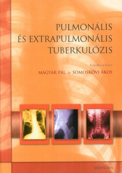 Magyar Pl   (Szerk.) - Somoskvi kos   (Szerk.) - Pulmonlis s extrapulmonlis tuberkolzis