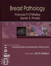 Frances P. O'Malley - Sarah E. Pinder - Breast Pathology