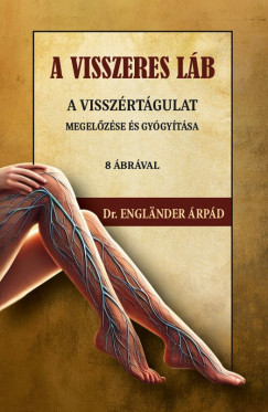 Dr. Englnder rpd - A visszeres lb a visszrtgulat megelzse s gygytsa