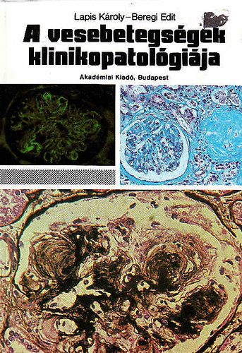 Lapis K�roly-Beregi Edit - A vesebetegs�gek klinikopatol�gi�ja