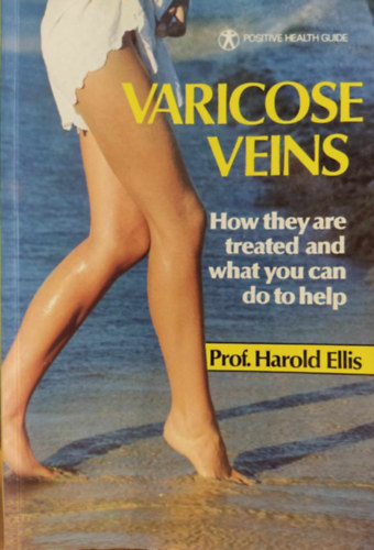 Prof. Harold Ellis - Varicose Veins: How they are treated and what you can do to help (Positive Health Guide)