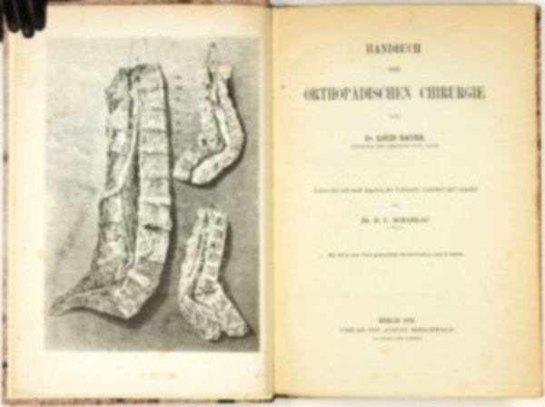 Louis Bauer - Handbuch der Orthop�dischen Chirurgie - Uebersetzt und nach Angaben des Verfassers ver�ndert und vermehrt von B.L. Scharlau