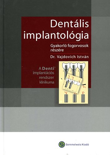 Dr. Vajdovich Istv�n - Dent�lis implantol�gia - Gyakorl� fogorvosok r�sz�re