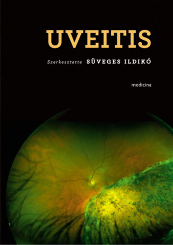 Süveges Ildikó - Uveitis