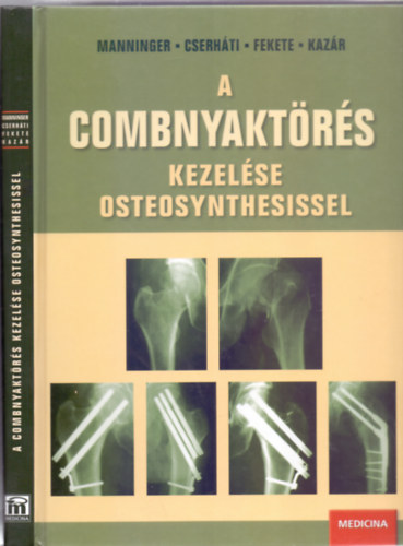 Szerkesztette: Manninger Jen - Cserhti Pter - Fekete Kroly - Kazr Gyrgy - A combnyaktrs kezelse osteosynthesissel (Dediklt)