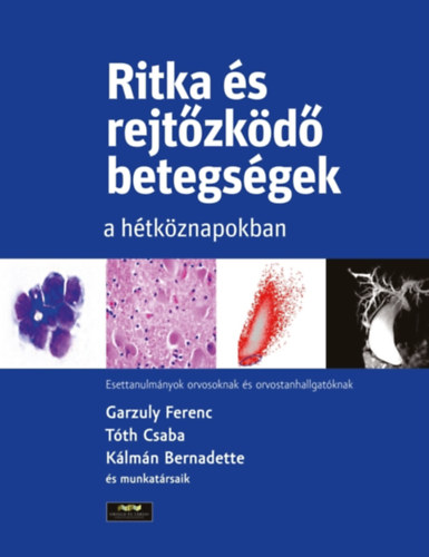 Garzuly Ferenc T�th Csaba K�lm�n Bernadette - Ritka �s rejt�zk�d� betegs�gek a h�tk�znapokban