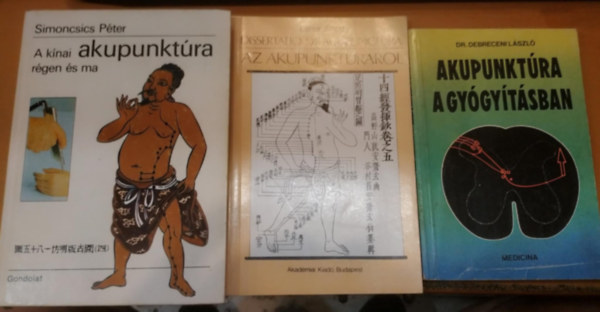 Dr. Laner Antal, Dr. Simoncsics Pter Debreceni Lszl - 3 db Akupunktra a gygytsban + Dissertatio de acupunctura az akupunktrrl + A knai akupunktra rgen s ma
