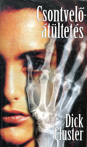 Dick Cluster - Csontvel��t�ltet�s