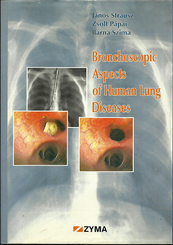 Strausz - Ppai - Szima - Bronchoscopic Aspects of the Human Lung Diseases