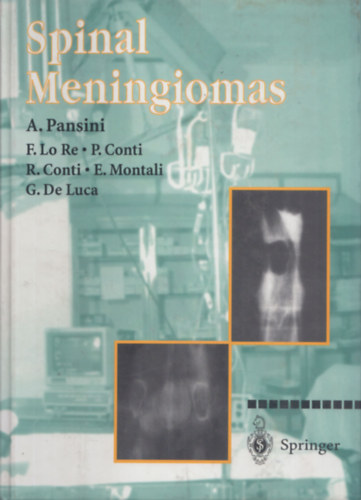 F. Lo Re, P. Conti, R. Conti, E. Montali, G. De Luca A. Pansini - Spinal meningiomas