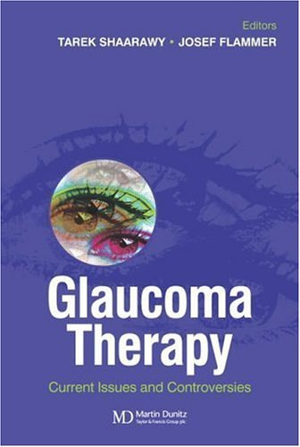 Glaucoma Therapy: Current Issues and Controversies