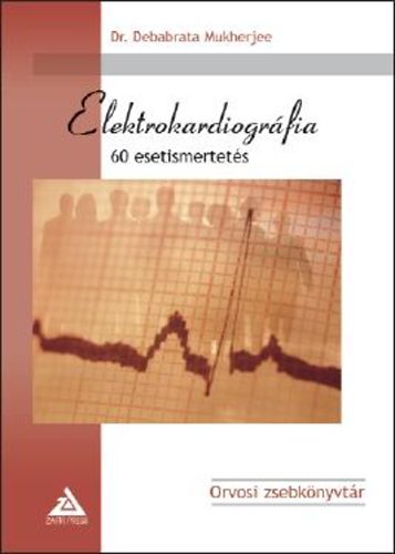 Dr. Debabrata Mukherjee - Elektrokardiogr�fia - 60 esetismertet�s