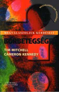Tim Mitchell Cameron Kennedy - B�rbetegs�gek - Megv�laszoljuk k�rd�seit