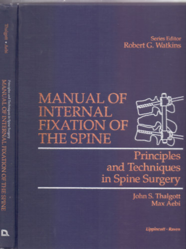 John S. Thalgott - Max Aebi - Manual of Internal Fixation of the Spine (Principles and Techniques in Spine Surgery)