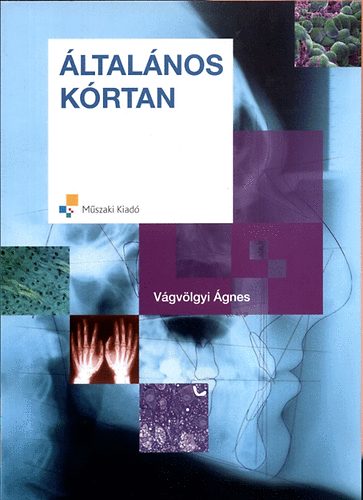 Vgvlgyi gnes - ltalnos krtan