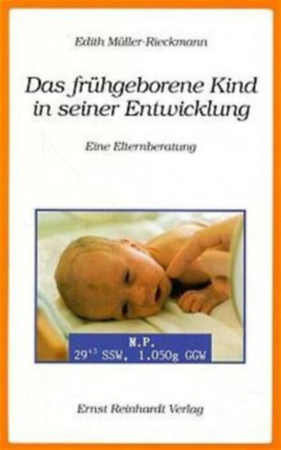Edith Mller-Rieckmann - Das frhgeborene Kind in seiner Entwicklung. Eine Elternberatung