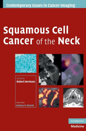 Rodney H. Reznek Robert Hermans - Squamous Cell Cancer of the Neck (Contemporary Issues in Cancer Imaging)