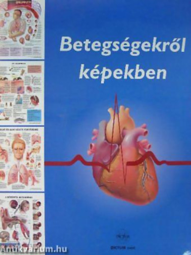 Anatomical Chart Company - Betegs�gekr�l k�pekben