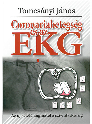 Tomcsnyi Jnos - Coronariabetegsg s az EKG (Az j kelet angintl a szvinfarktusig)