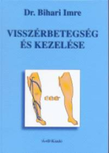 Dr. Bihari Imre - Visszérbetegség és kezelése