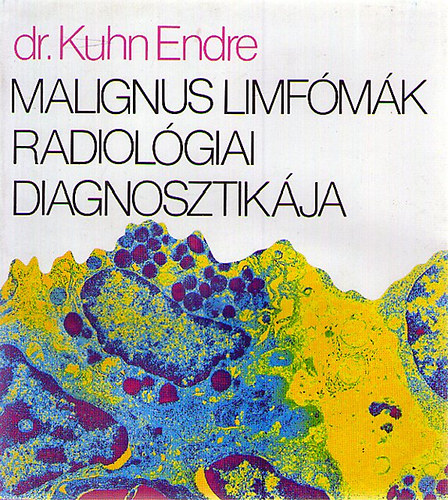 Dr. Kuhn Endre - Malignus limfmk radiolgiai diagnosztikja
