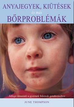 June Thomson - Anyajegyek, ki�t�sek �s m�s b�rprobl�m�k