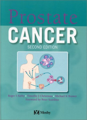 Timothy J. Christmas, Michael K. Brawer Roger S. Kirby - Prostate Cancer - Second edition