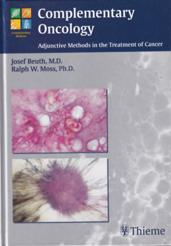 Ralph W. Moss Josef Beuth - Complementary Oncology