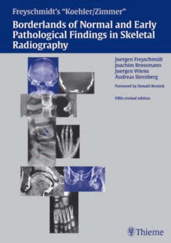Joachim Brossmann, Juergen Wiens, Andreas Sternberg, Donald Resnick MD Juergen Freyschmidt - Koehler/Zimmer's Borderlands of Normal and Early Pathological Findings in Skeletal Radiography