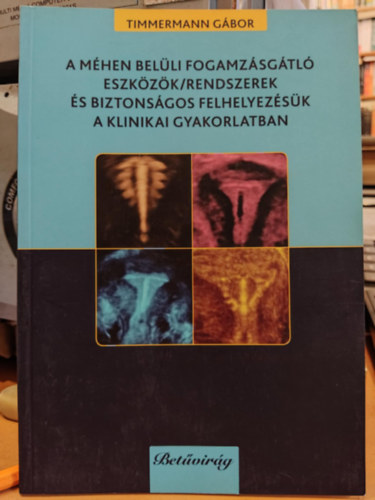 Timmermann Gábor - A méhen belüli fogamzásgátló eszközök/rendszerek és biztonságos felhelyezésük a klinikai gyakorlatban (Betűvirág)