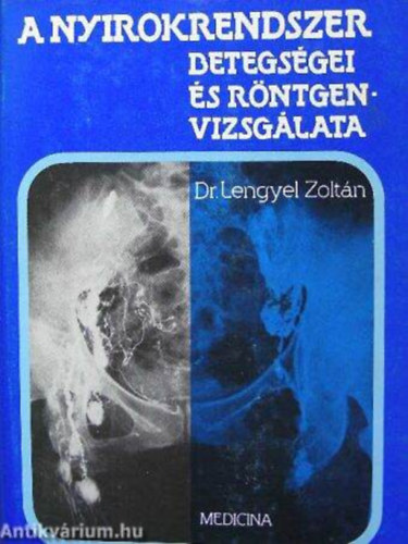 Dr. Lengyel Zoltn - A nyirokrendszer betegsgei s rntgenvizsglata