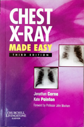 Jonathan Corne - Kate Pointon - Chest X-ray - Made easy