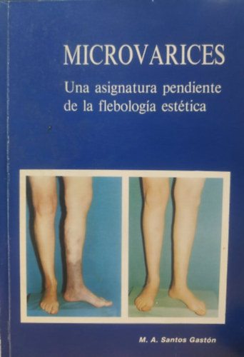 M. A. Santos Gastón - Microvarices: Una asignatura pendiente de la flebología estética (Industrias Graficas Gracia)