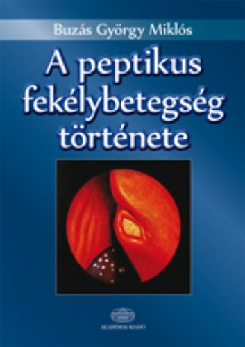 Buz�s Gy�rgy Mikl�s - A peptikus fek�lybetegs�g t�rt�nete