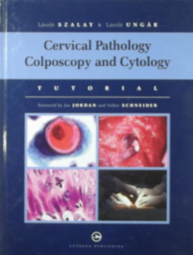 Ung�r L�szl� Szalay L�szl� - Cervical Pathology Colposcopy and Cytology - M�hnyak patol�gia Kolposzk�pia �s citol�gia