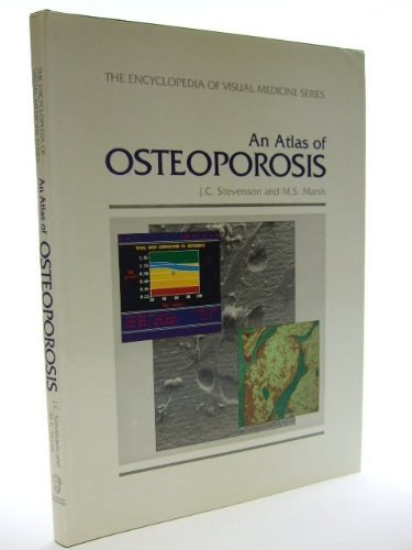 M.S. Marsh J.C. Stevenson - An Atlas of Osteoporosis