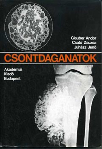 Glauber Andor; Csató Zsuzsa; Juhász Jenő - Csontdaganatok